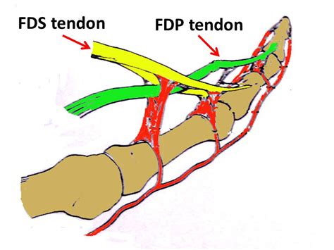 fdp tendon insertion